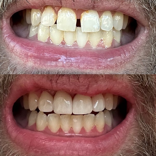 JOE Richard Keneson, DDS — pediatric dentist in Silsbee