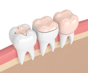 Lindsay Tilger, DDS — pediatric dentist in Houston